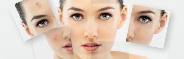 Connaitre sa peau - la peau mixte