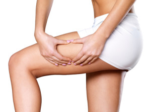 Quels alliés anti-cellulite pour cet été ?
