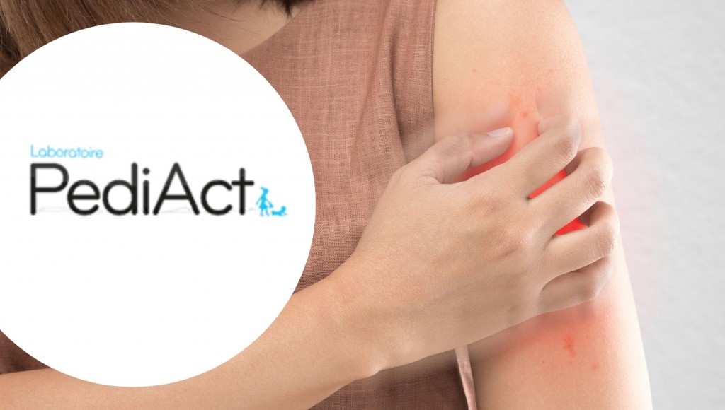 Testez gratuitement PoxClin Démangeaisons LABORATOIRES PEDIACT
