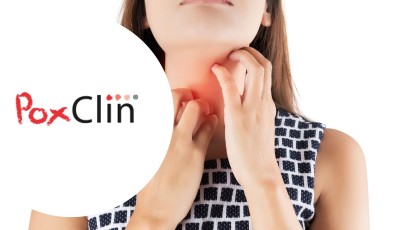 Testez gratuitement la mousse anti-démangeaisons de PoxClin