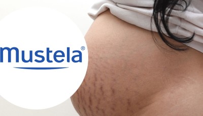 Testez gratuitement la crème vergetures de Mustela