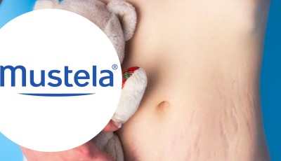 Testez gratuitement l\'huile anti-vergetures de Mustela