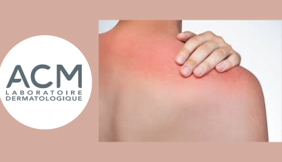 Recevez gratuitement la crème apaisante Cicastim A d’ACM