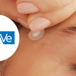 Testez gratuitement les patchs anti-imperfections de CeraVe