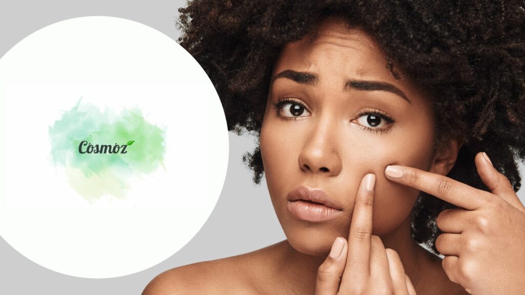 Testez gratuitement le sérum “La Guerre aux Boutons” de Cosmoz
