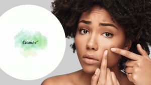 Testez gratuitement le sérum “La Guerre aux Boutons” de Cosmoz